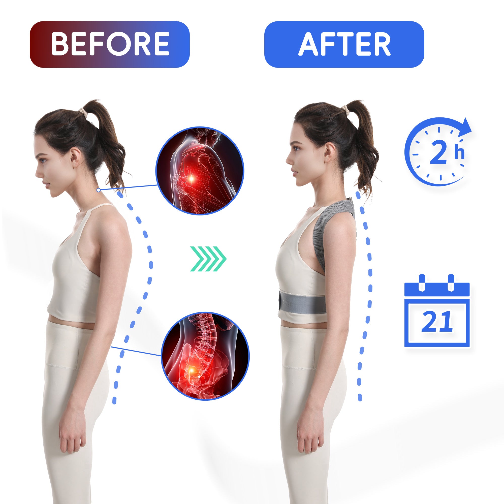 PosturePro Back Brace | Adjustable Posture Corrector for Men & Women